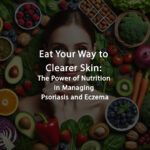 Power of Nutrition in Managing Psoriasis and Eczema