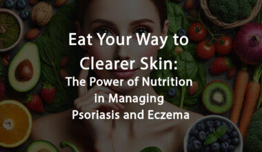Power of Nutrition in Managing Psoriasis and Eczema