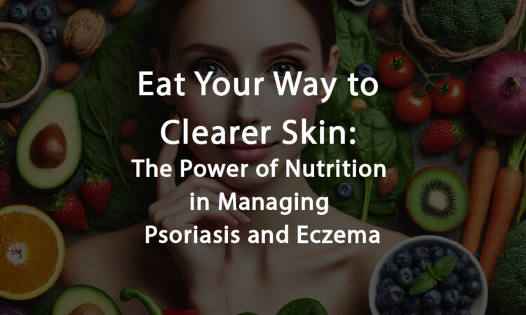 Power of Nutrition in Managing Psoriasis and Eczema